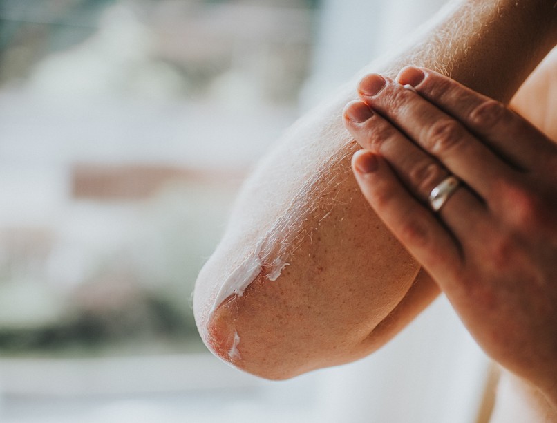 pikkelysömör oka gyógyszer ront