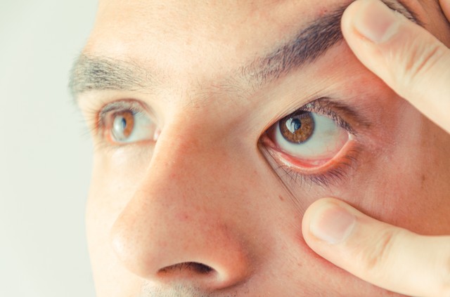 Retinoblastoma: tünet, vizsgálat és kezelési lehetőségek