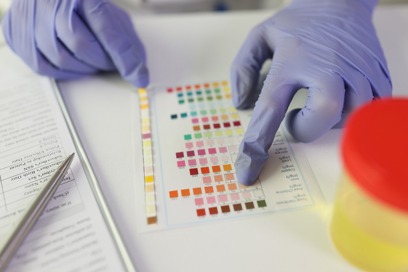 A hőség a veséket is ostromolja - ha ilyen színű a vizelete, már dehidratált, sürgősen igyon vizet!