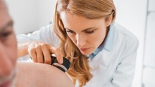 A testének ezt a részét szinte mindenki elfelejti bekenni – pedig itt gyakran alakul ki melanóma című cikk nyitóképe