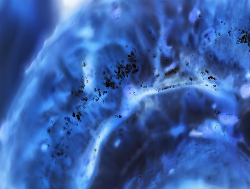 kialakulás előtt diagnosztizálható rák