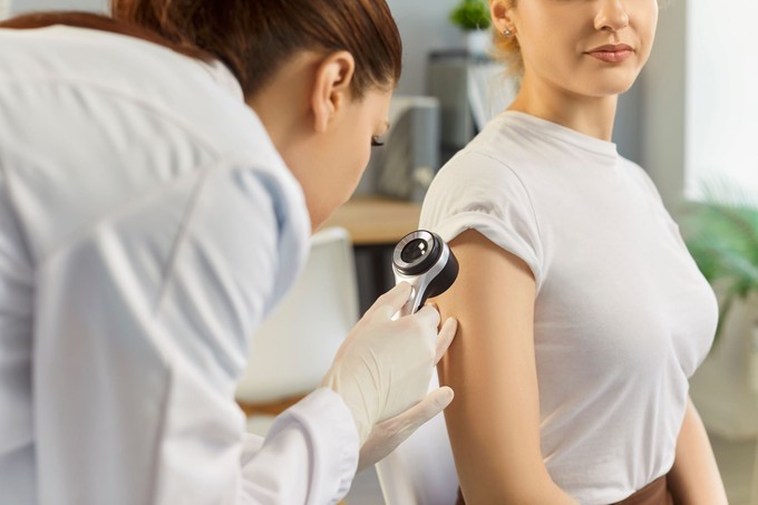 Az ilyen bőrdagnat mellett kétszer nagyobb az esély rá, hogy valamilyen más rák is kialakul  című cikk nyitóképe