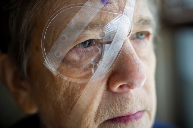 Mire vigyázzunk szürkehályog-műtét után? Ezeket tartsa be a gyógyulás érdekében