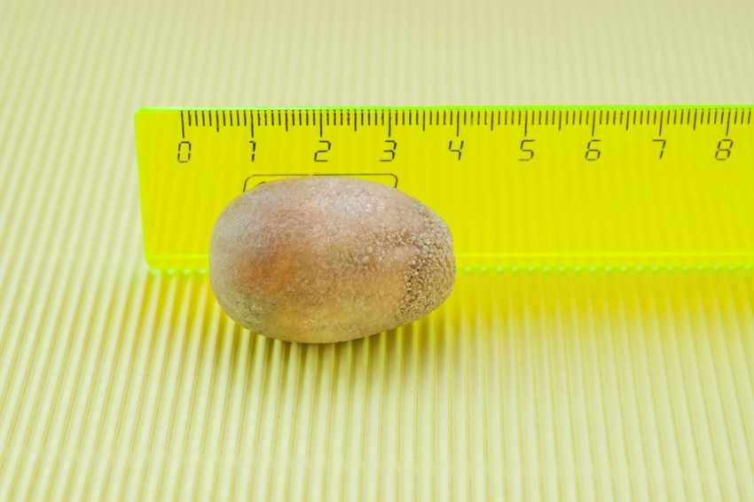 A kövek mérete a több centit is elérheti. Az epeköveket nagyrészt koleszterin alkotja és gyakran sárga színűek. A kövekben leginkább feloldatlan koleszterin található, de más anyag is lehet benne.