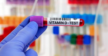 D-vitamin szint: kockázatot jelent, ha nincs legalább ennyi a szervezetben