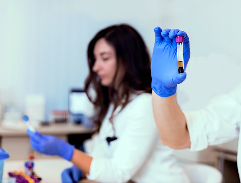 trombózis, érvizsgálat, vérvizsgálat, szűrővizsgálat, boka kar index