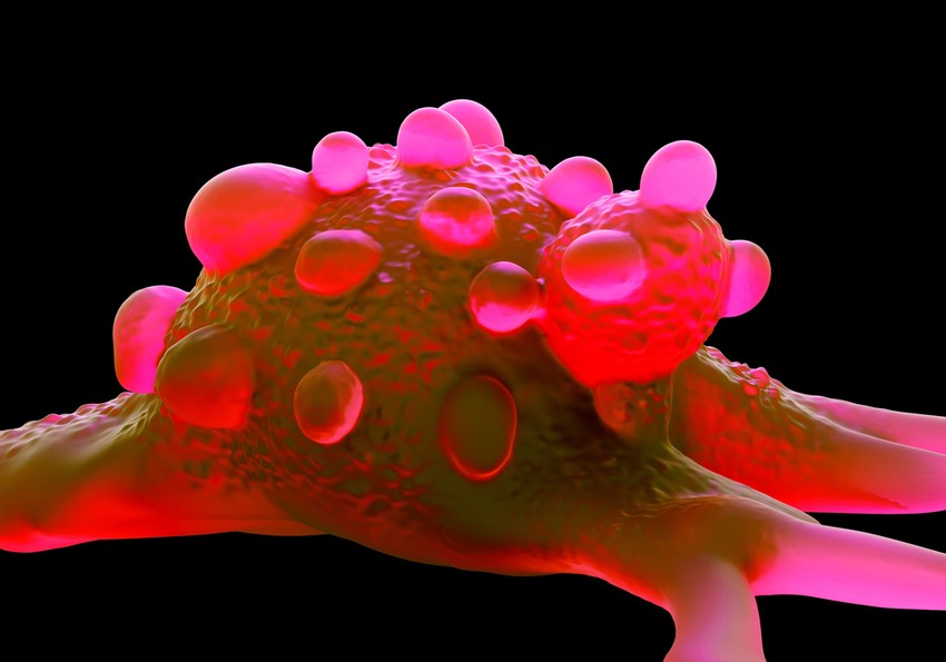 Ezek a tünetek utalhatnak húgyhólyagrákra.