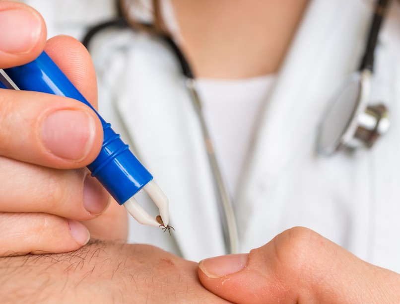 Kullancs kiszedése csipesszel, kanállal