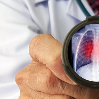 RSV-fertőzés: tünetei, vizsgálata és kezelési lehetőségei című cikk nyitóképe