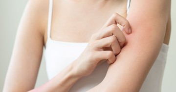 Innen tudhatja, hogy a viszketés nem csupán bőrprobléma, hanem súlyos daganat jele