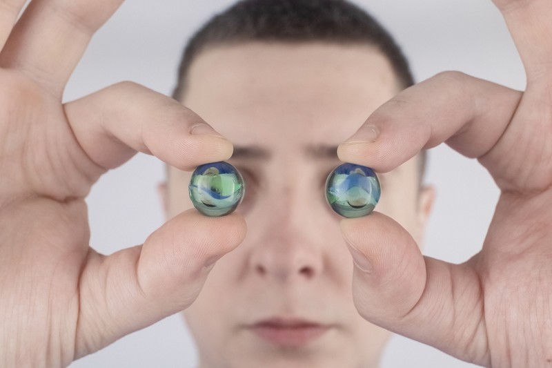 Szaruhártyahomály: ez a zsíranyagcsere-zavar kevésbé ismert tünete