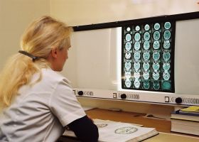 Szoftverekkel - a daganatos betegségek ellen is