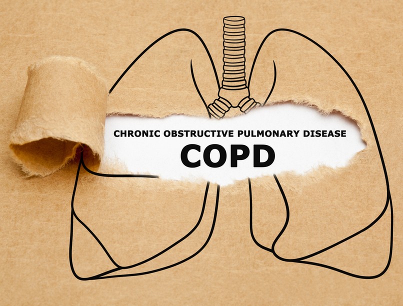 copd, diéta, tüdőbetegség