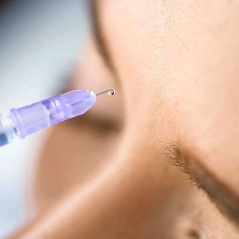Miben segíthet a Botox-terápia? Fogcsikorgatástól az arcidegzsábáig című cikk nyitóképe