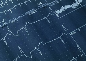 Betegvizsgálat: mit mutat az EKG?