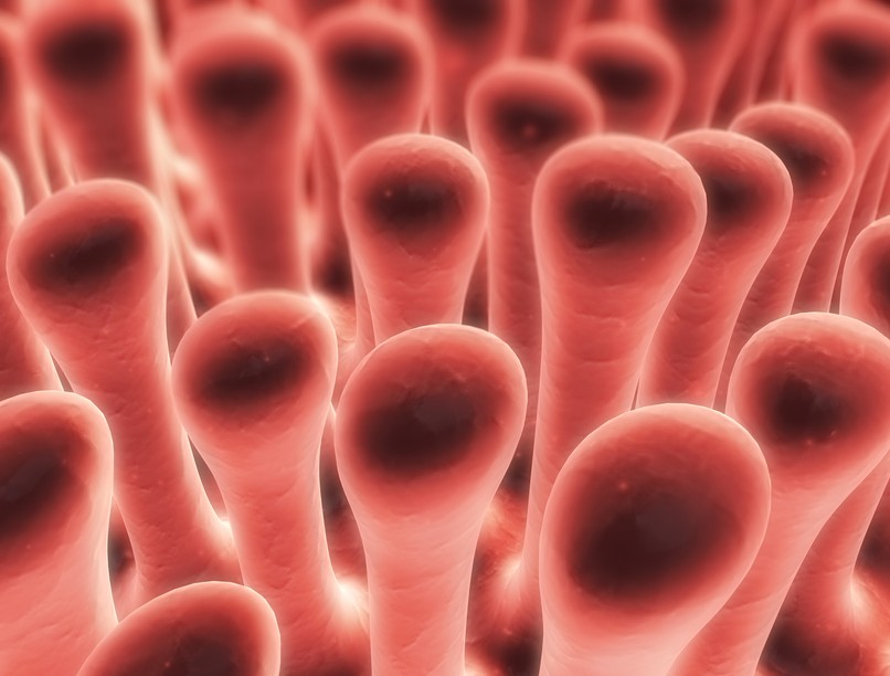 gyomortükrözés bélbolyhok gluténérzékenység cöliákia