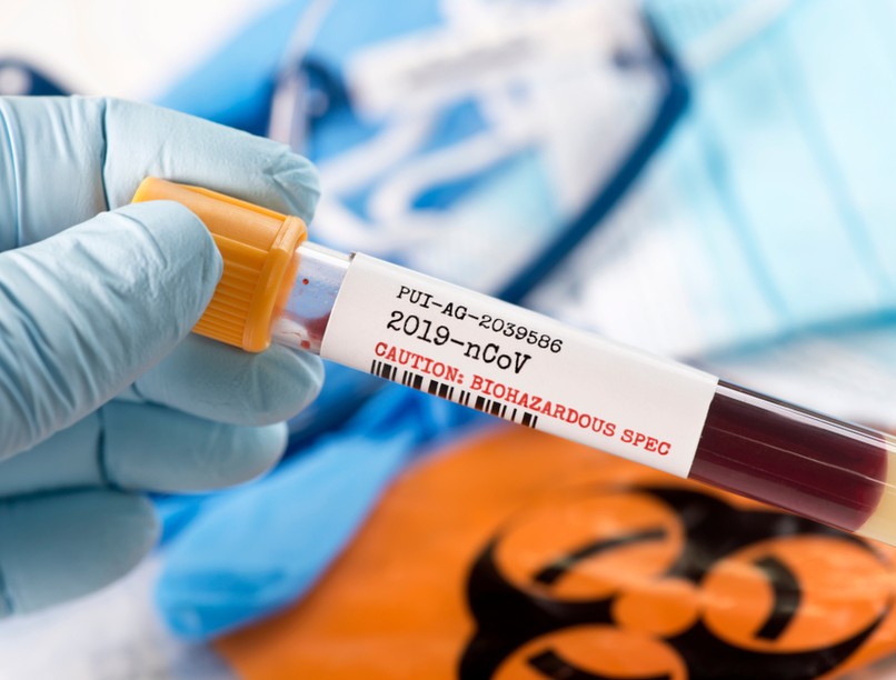 koronavírus, teszt