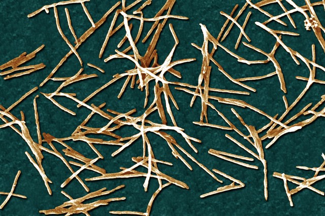 Több mint izgalmas, amit a rákos sejtekkel tesz ez a baktérium!