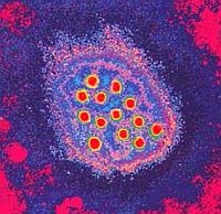 A Hepatitis Világnap margójára: "gondold újra!"