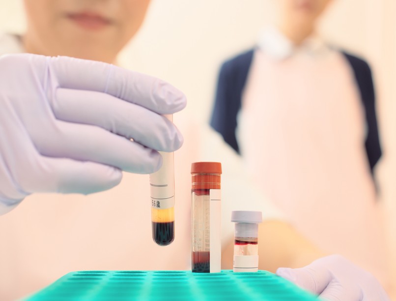 vértisztító eljárás, szeged