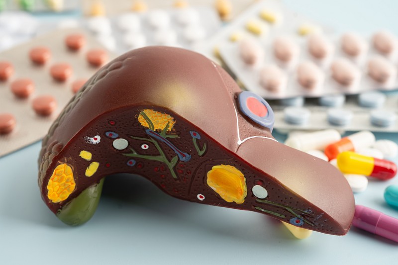 Zsírmáj: visszafordíthatja-e egy egyszerű vitamin a világ leggyakoribb májbetegségét?