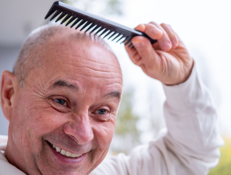 kopaszodás ellen készítmény