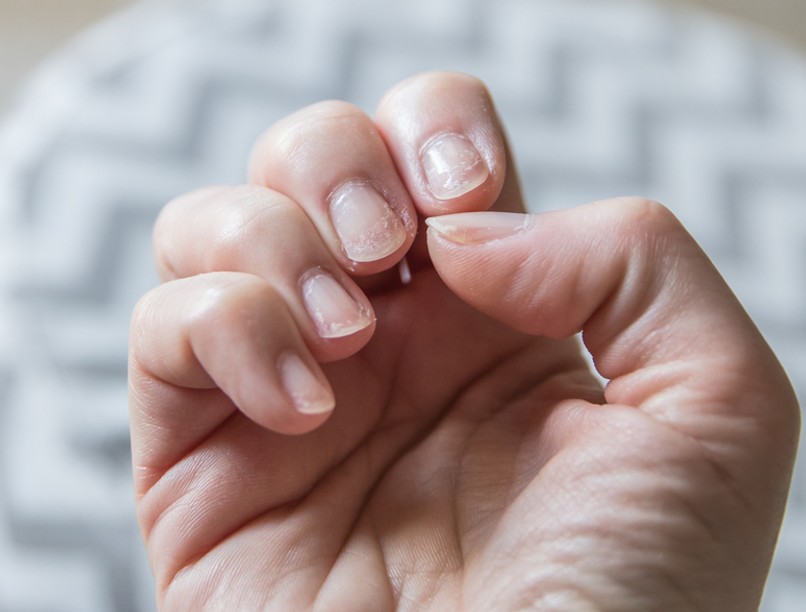 vashiány, tünetei, fáradtság, pajzsmirigy, vérszegénység, vitamin, fáradékonyság