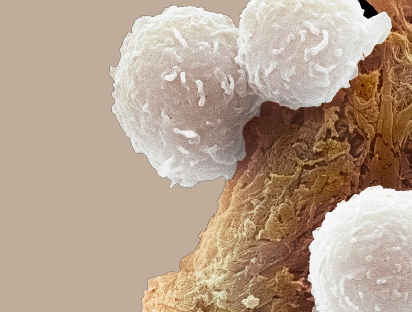 vér vizsgálat érték rák cukorbetegség kutatás