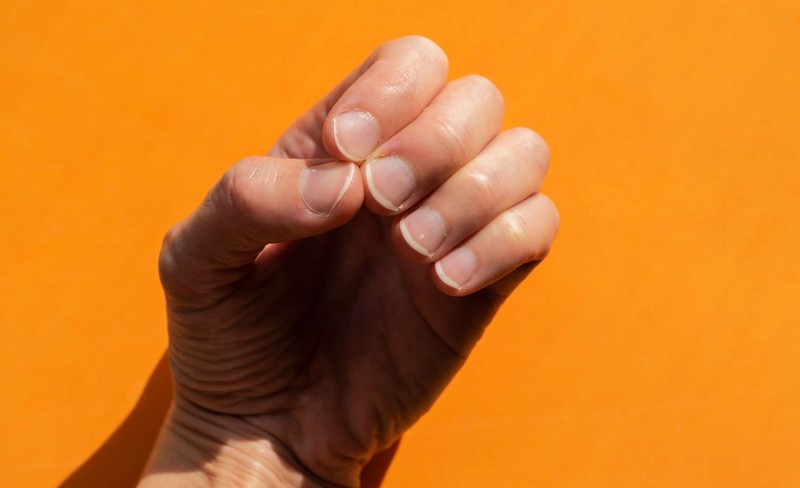 Egy sötét csík, egy furcsa forma – 5 jel, amikor a körmök daganatra figyelmeztetnek