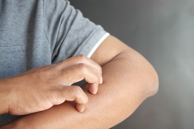 Az orvos videóban hívta fel a figyelmet a májkárosodás 4 jellegzetes bőrtünetére című cikk nyitóképe