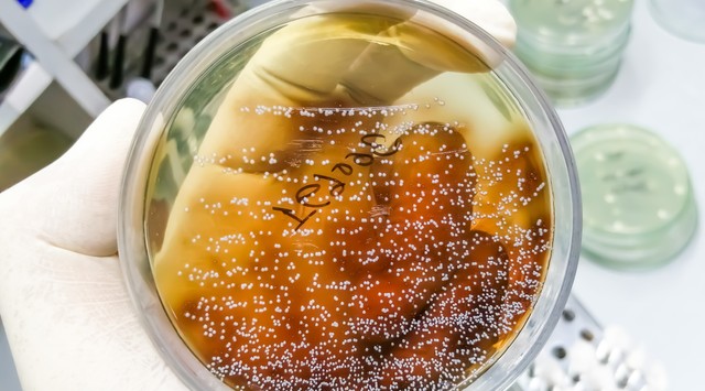 Felgyorsíthatják a daganat növekedését ezek a rákos sejtben megbúvó gombák