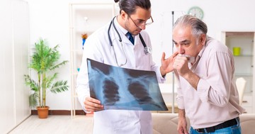  Elhúzódó, makacs köhögés: ekkor utalhat tüdőrákra 