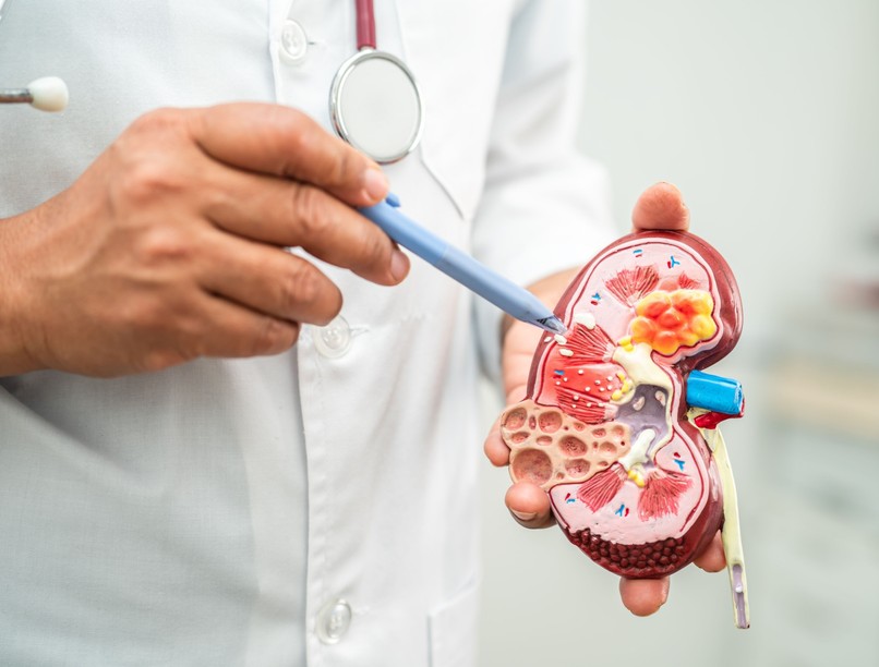 krónikus veseelégtelenség beszűkült vesefunkció gyógyítása elkerül dialízis