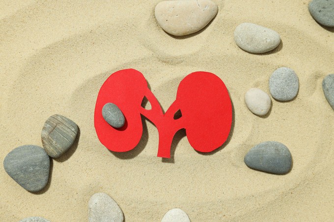 Szúró, csípő érzés a vizelés legvégén? Ez a vesehomok egyik legjellegzetesebb tünete című cikk nyitóképe