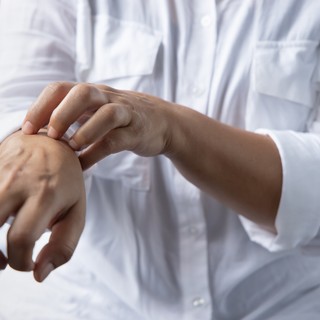 Mikor múlik el a rühesség? című cikk nyitóképe