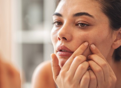 Mitesszeres a bőre? Ezeket a praktikákat próbálja ki otthon! című cikk nyitóképe