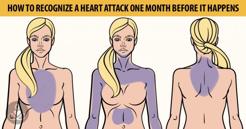 A szívroham jeleit egy hónappal a tényleges roham előtt észlelhetjük