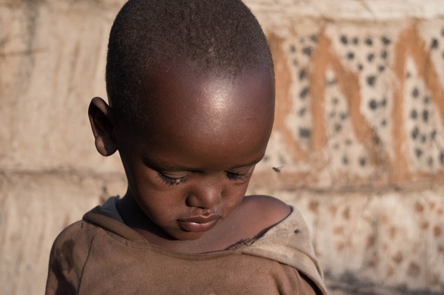 Álomkór: ezek a tünetei