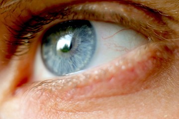 Ezeket javasolta a bükki füvesember a gyulladt szemekre és a  szürkehályogra