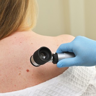 Áttörés a melanoma kezelésében: ígéretes a személyre szabott mRNS-terápia című cikk nyitóképe