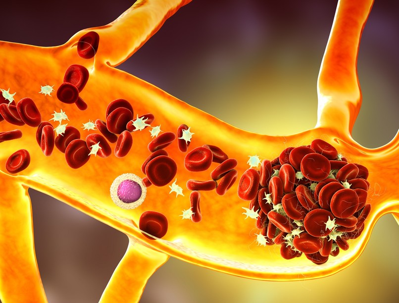 légszomj tüdőembólia életveszélyes tünet