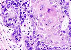 A szőlőmagkivonat rákellenes hatása?