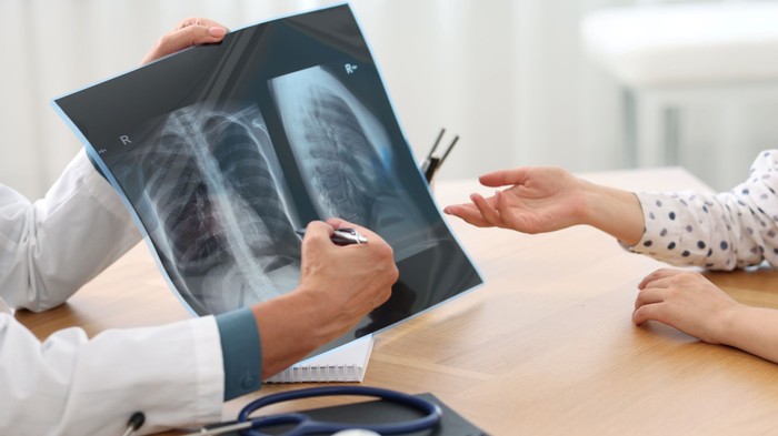 Milyen gyakran lehet röntgenezni? Ez a modern orvostudomány válasza egy régi félelemre című cikk nyitóképe