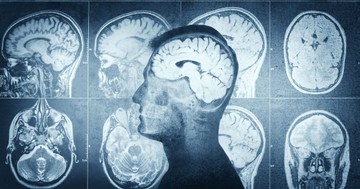  4 mindennapi szokás, amely észrevétlenül felgyorsíthatja az agy öregedését 