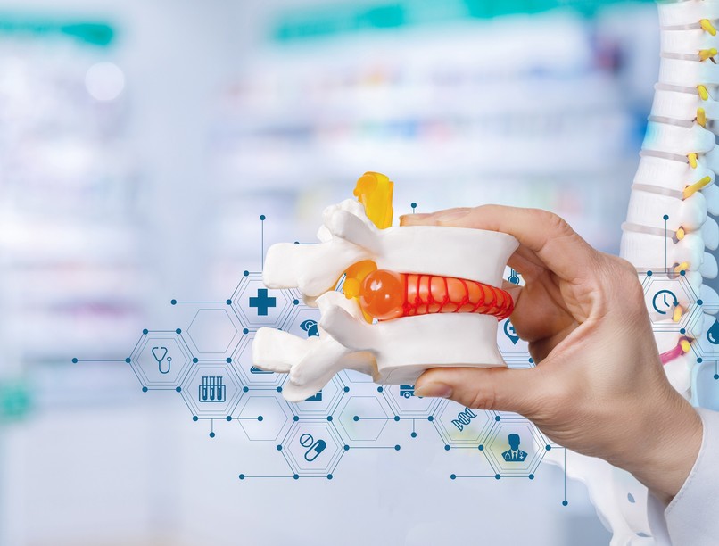 mozgásszervi betegségek mikor kell műteni a gerincsérvet