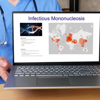 Mononukleózis (csókbetegség): tünete, szövődményei és kezelése című cikk nyitóképe