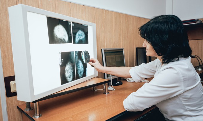 Szoptatás után mennyi időnek kell eltelnie egy mammográfiai vizsgálat előtt? Az orvos válaszol című cikk nyitóképe