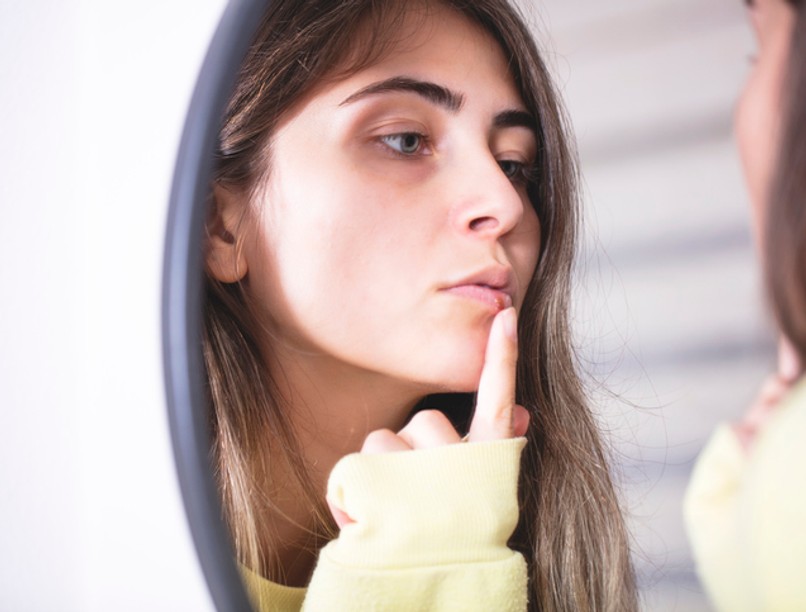 herpesz, koronavírus, tünet, afta, covid