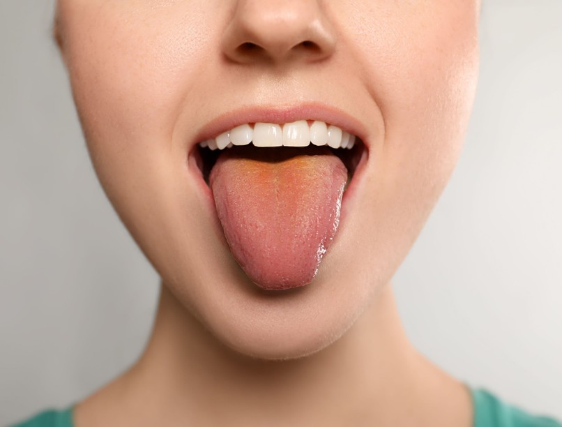 nyelv egészség betegség program