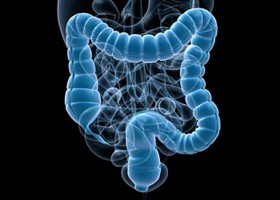 Mindent a vastag- és végbélrák szűrésről